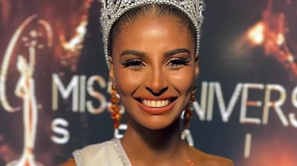 Meet Miss Spain: Beauty queen, 21, who overcame a 