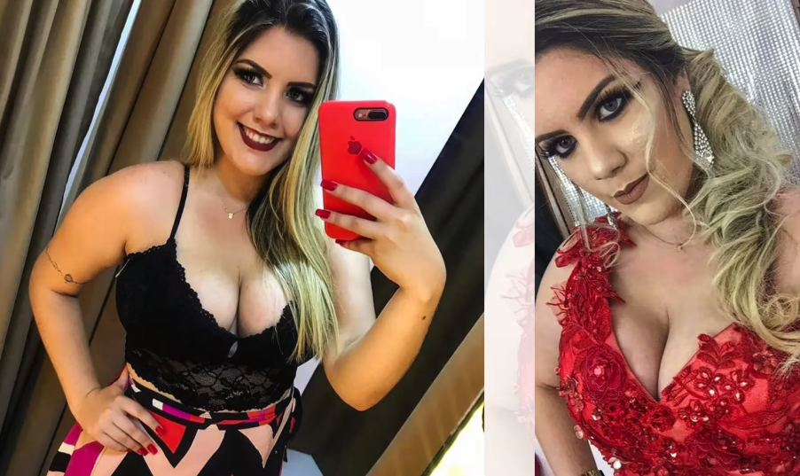 Brazilian Woman Dies After Undergoing Six Cosmetic Surgeries in 8 Hours Through Surgeon She Found Online [Video]