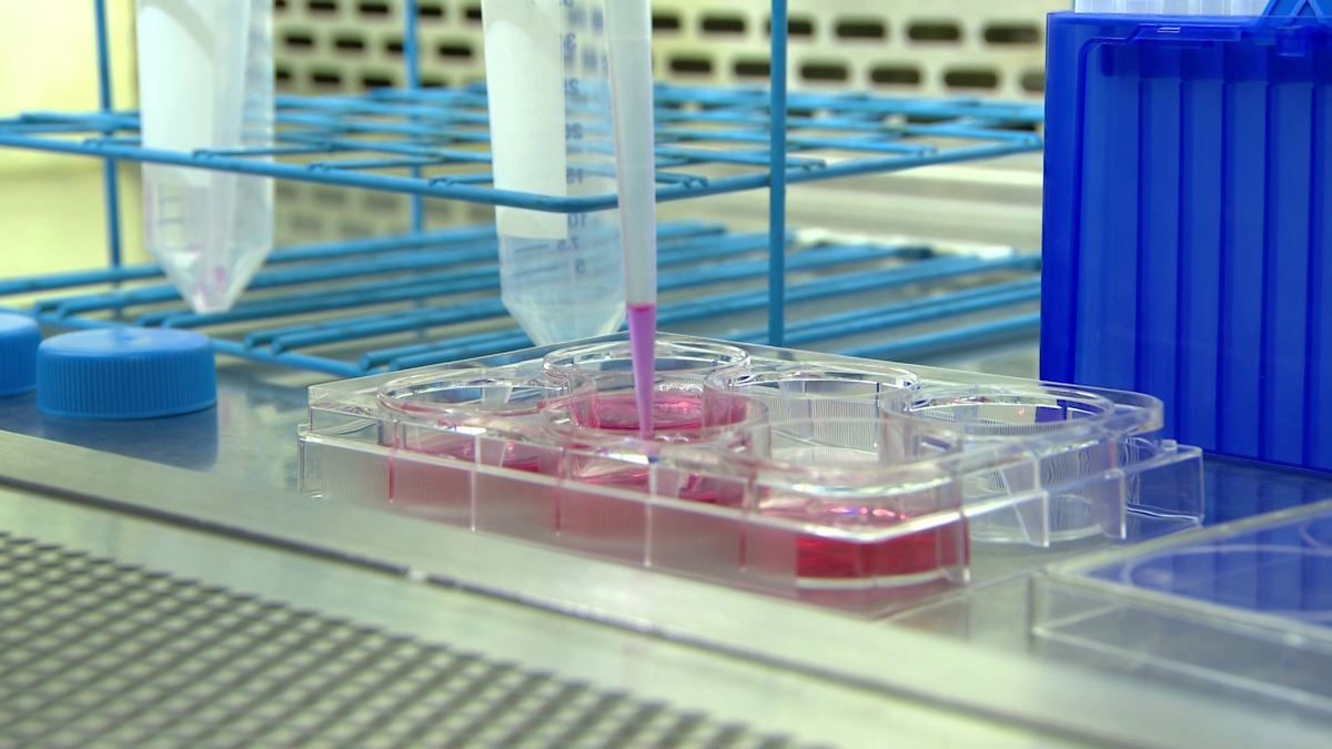 Gene therapy offers hope for kids with Hirschsprung disease [Video]