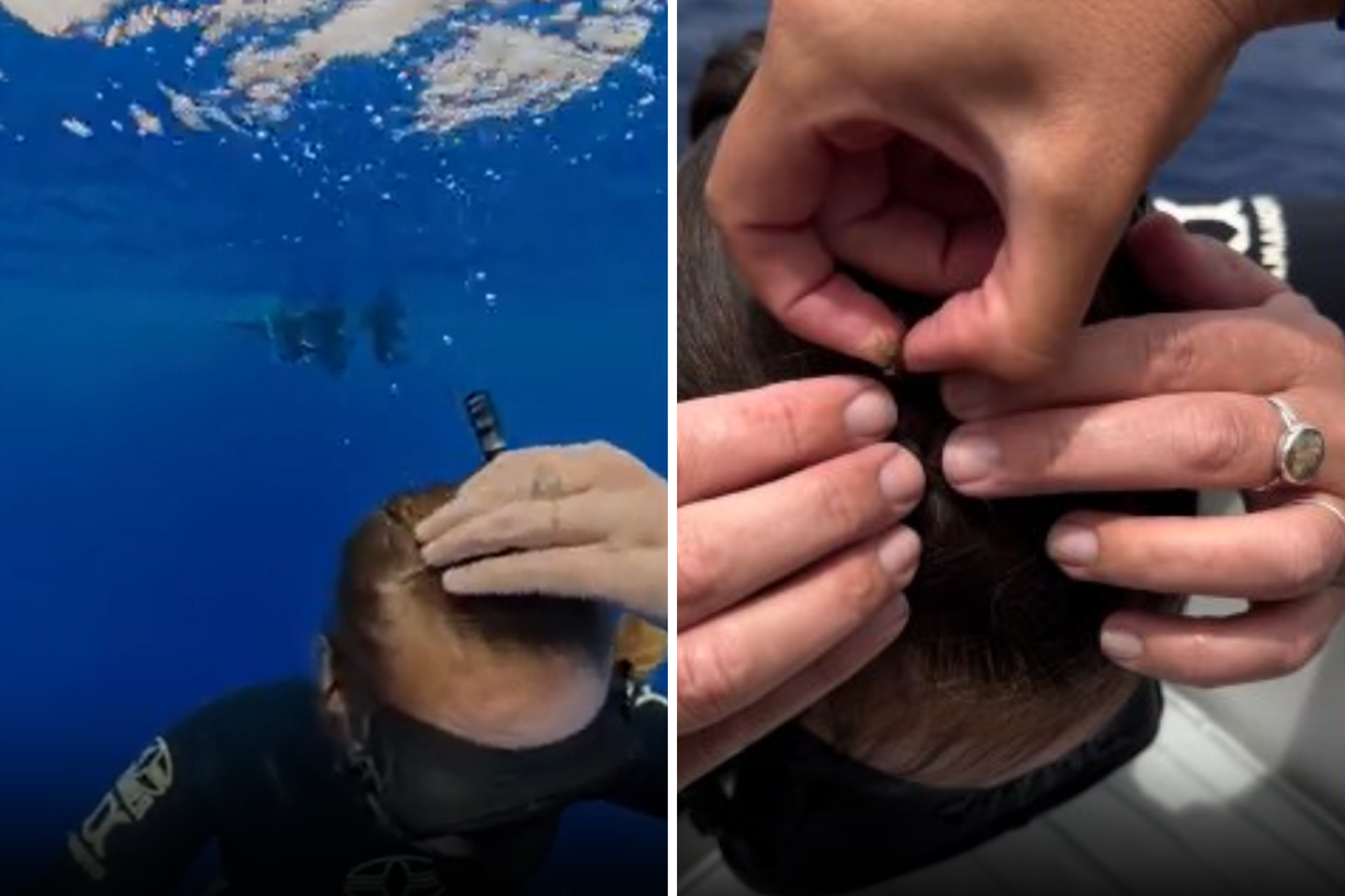 Woman Scuba Dives In Ocean, Then Feels Something ‘Crawl’ Across Her Skin [Video]